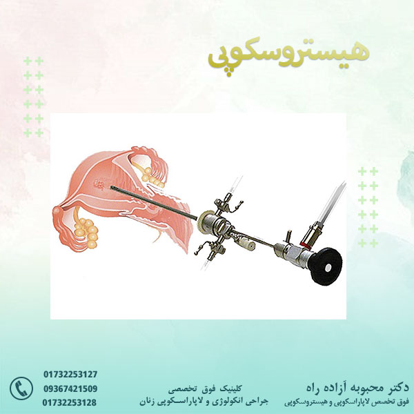 هیستروسکوپی - دکتر آزاده راه