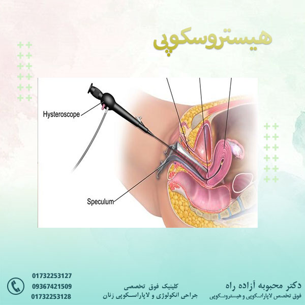 هیستروسکوپی - دکتر آزاده راه