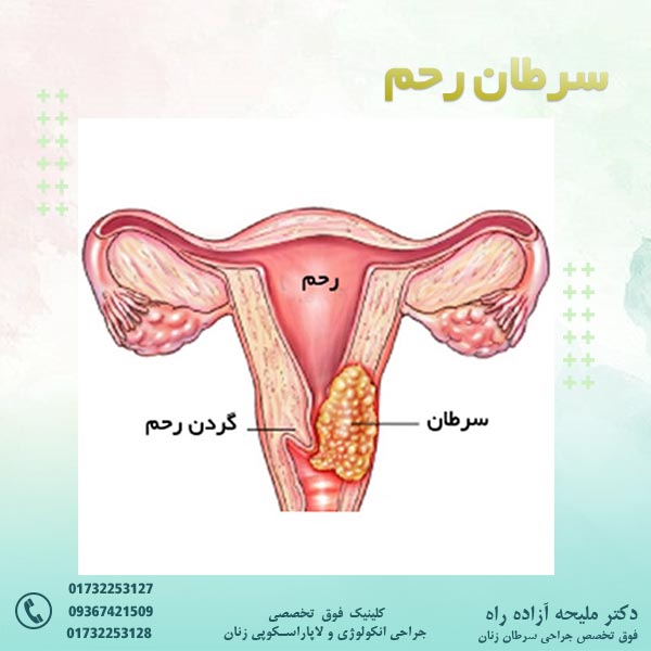 سرطان رحم - دکتر آزاده راه