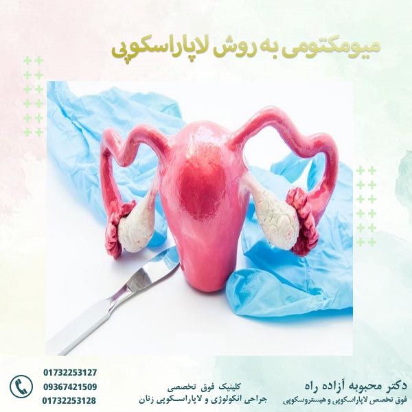 میومکتومی به روش لاپاراسکوپی
