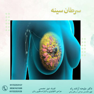 سرطان سینه - دکتر آزاده راه