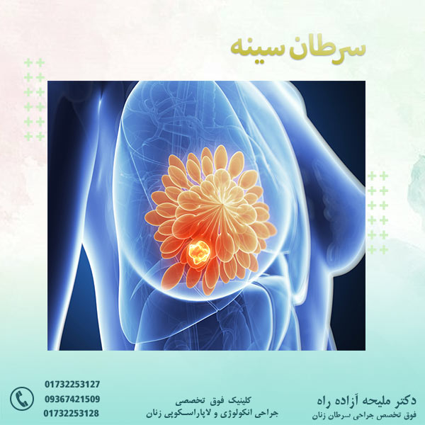 سرطان سینه