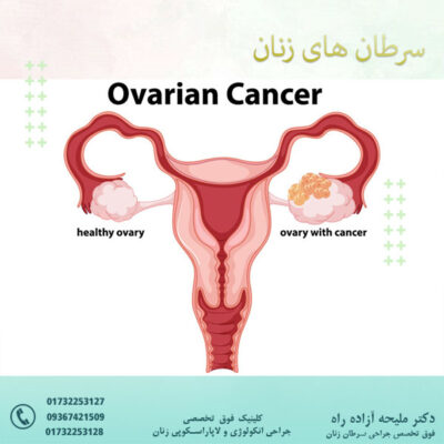 سرطان های زنان - دکتر آزاده راه
