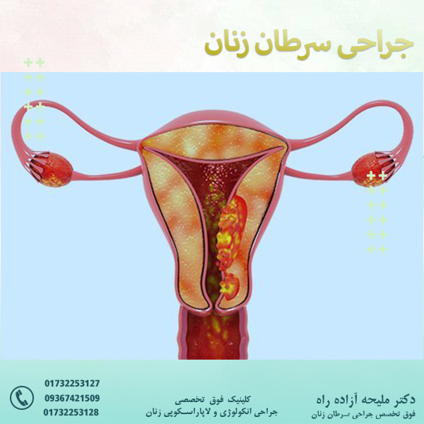 جراحی سرطان زنان