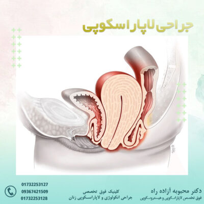 افتادگی رحم - دکتر آزاده راه