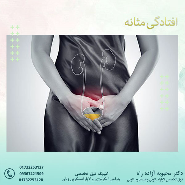 افتادگی مثانه