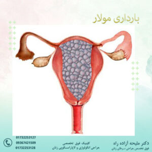 بارداری مولار
