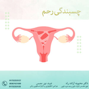 چسبندگی رحم - دکتر آزاده راه