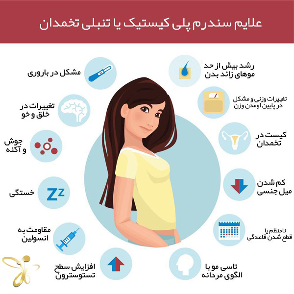 تنبلی تخمدان - دکتر آزاده راه