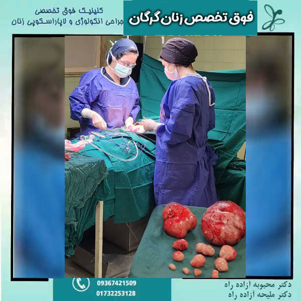 فوق تخصص زنان گرگان