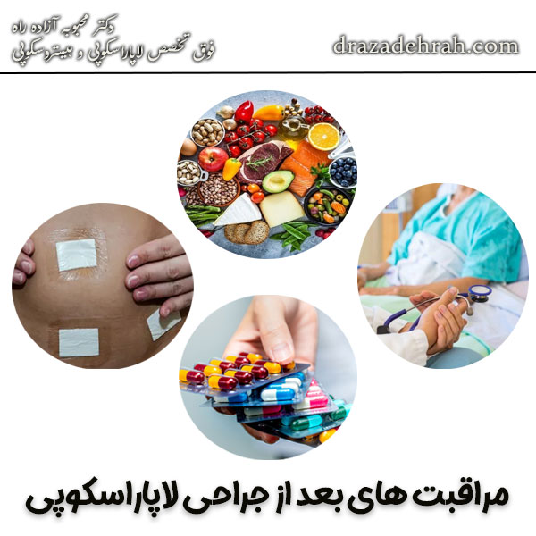 مراقبت های بعد از جراحی لاپاراسکوپی رحم