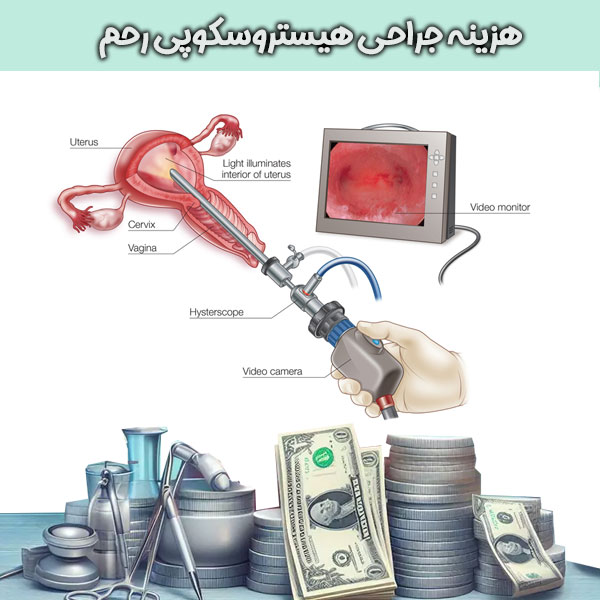 هزینه جراحی هیستروسکوپی رحم کلینیک آزاده راه در گرگان