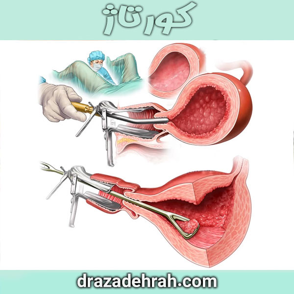 کورتاژ از کلینیک آزاده راه در گرگان