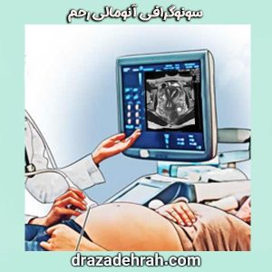 سونوگرافی آنومالی رحم در کلینیک فوق تخصصی دکتر آزاده راه در گرگان