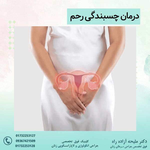 درمان چسبندگی رحم