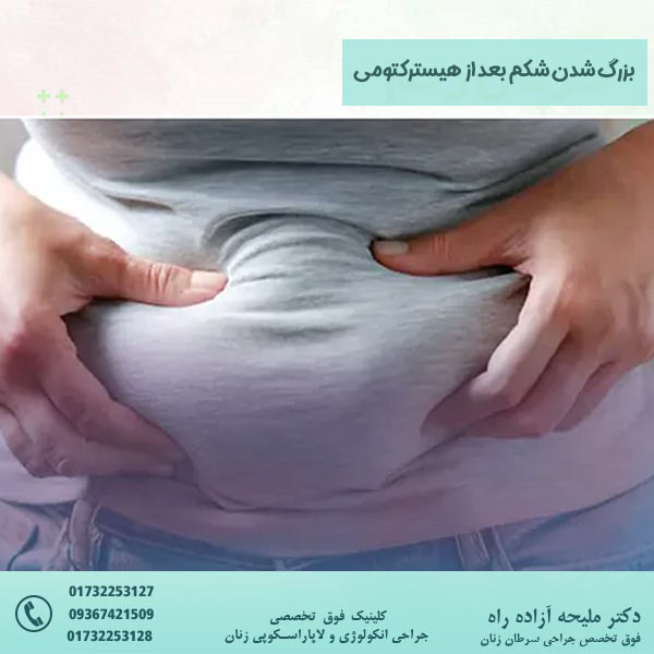 بزرگ شدن شکم بعد از هیسترکتومی