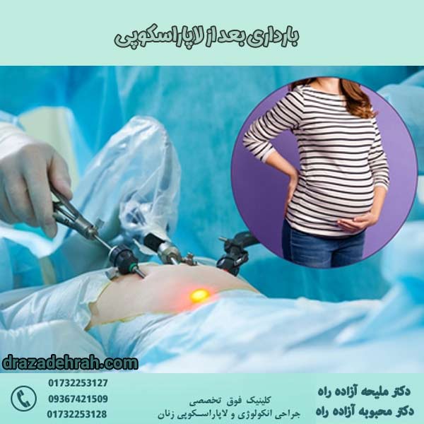 بارداری بعد از لاپاراسکوپی