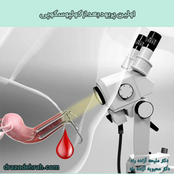 اولین پریود بعد از کولپوسکوپی